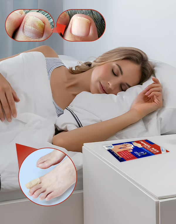 Svampdödande nagelklistermärken