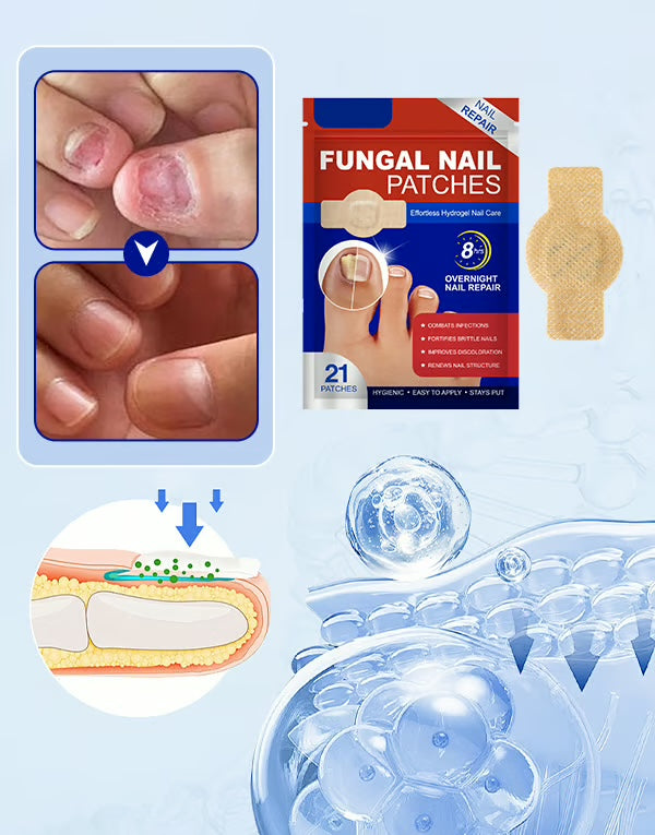 Anti-Svamp Nagelplåster