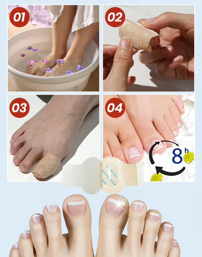Anti-Svamp Nagelplåster