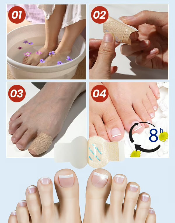 Svampdödande nagelklistermärken