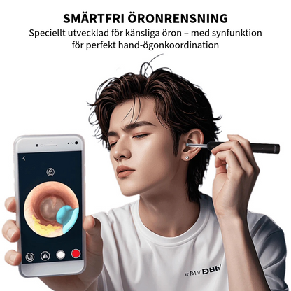 Professionell öronvaxborttagare med kamera