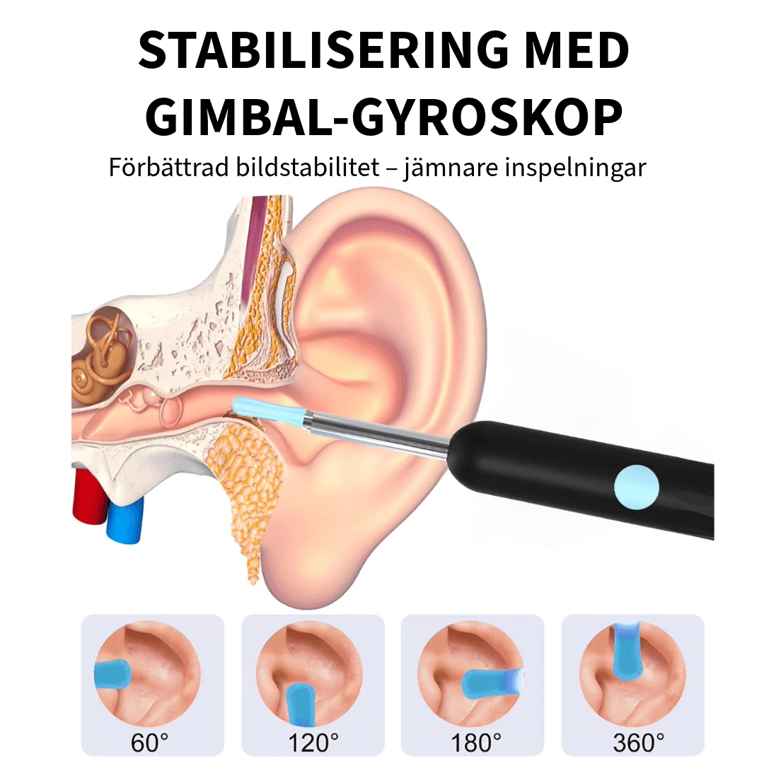 Professionell öronvaxborttagare med kamera