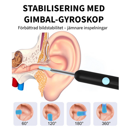 Professionell öronvaxborttagare med kamera