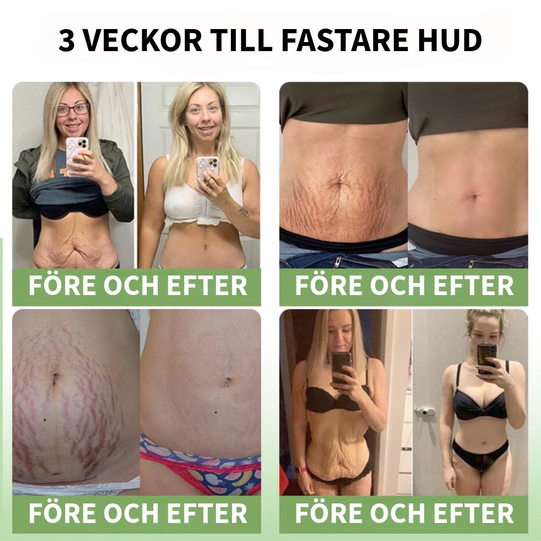 Kollagenkräm