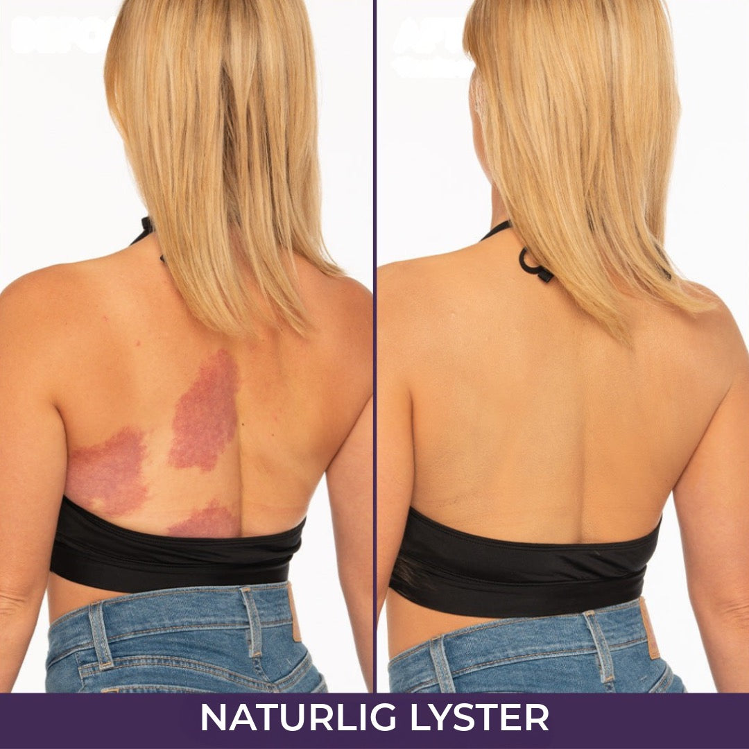 Naturlig Foundation